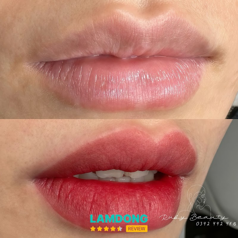 Ruby Xoá Xăm Đà Lạt – Phù Đổng Thiên Vương