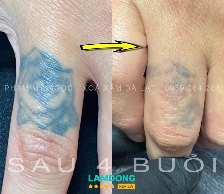Phạm Mỹ Ngọc Đà Lạt – xóa mày và phun xăm