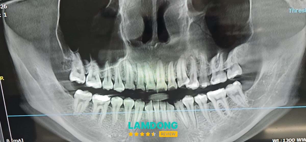 NHA KHOA BẢO ANH Đức Trọng – thiết bị điều trị